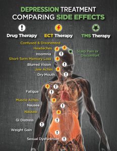 Side Effect Comparison: Antidepressants vs ECT vs. TMS Therapy Treatment in Tacoma